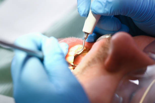 Best Emergency Treatment for Toothache in Balcones Heights, TX