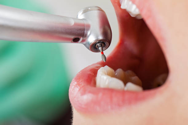 Best Emergency Broken Tooth Repair in Balcones Heights, TX